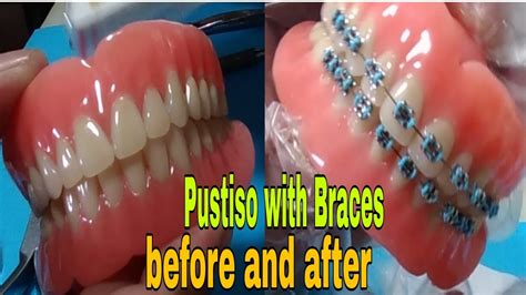 Pustiso in English .